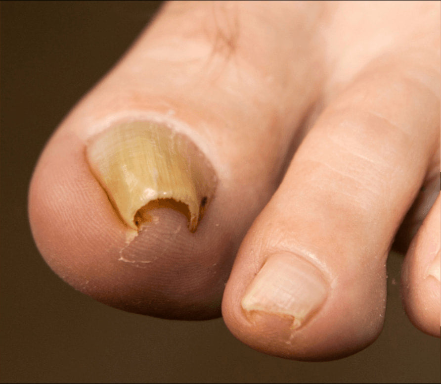 Before treatment