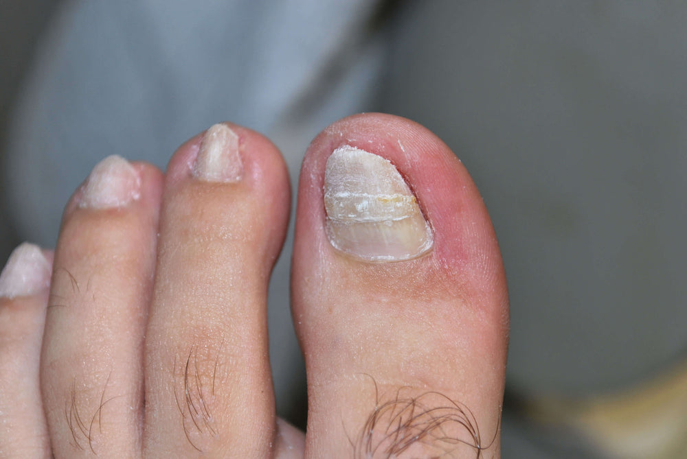 After treatment