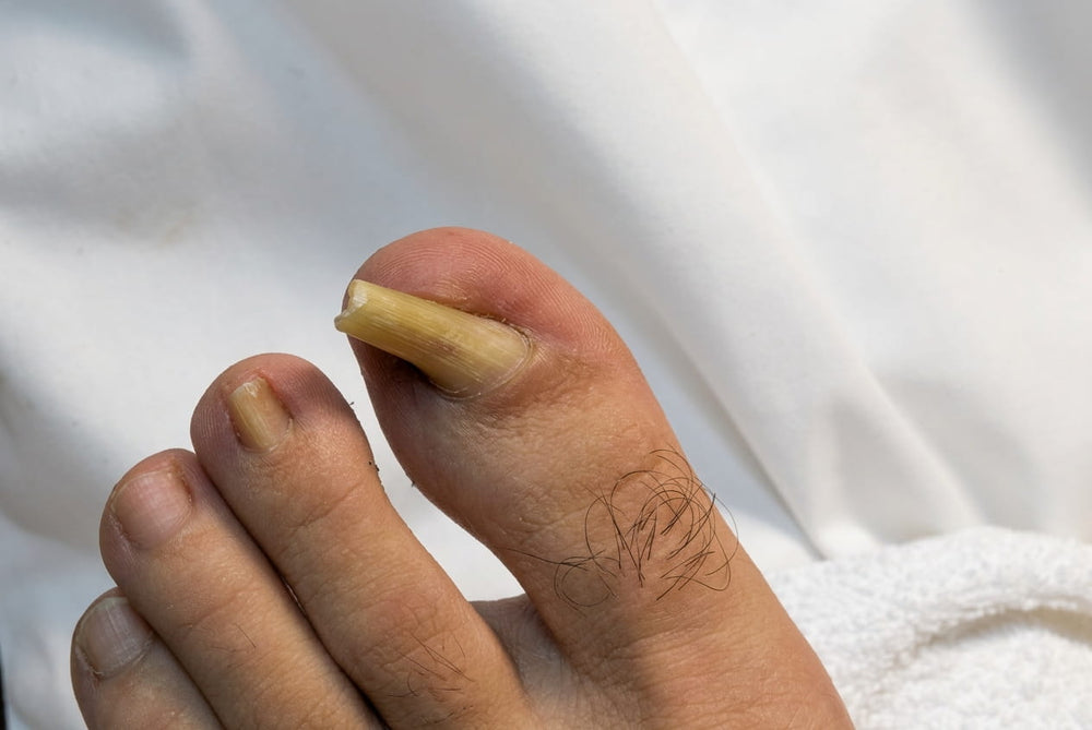 Before treatment