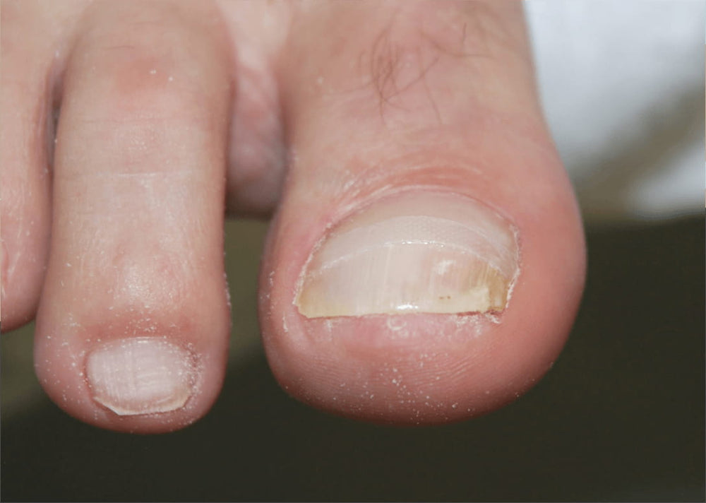 After treatment