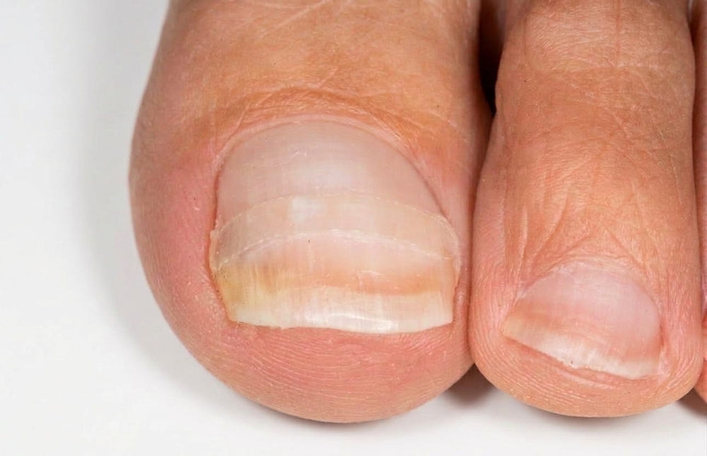 After treatment