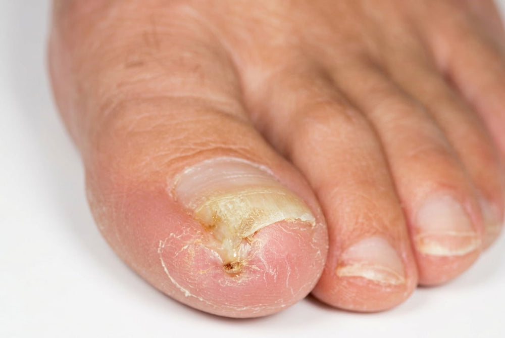 Before treatment
