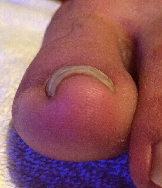 Before treatment